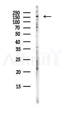 ROCK1 Antibody - Western blot analysis of lysates from EC304 cells(heat-shock,45min treatment), using ROCK1 Antibody at 1/1000 dilution.