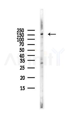 ROCK1 Antibody - Western blot analysis of lysates from HUVEC cells(starvation,24h treatment), using ROCK1 Antibody at 1/1000 dilution.