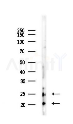 HMGB1 Antibody - Western blot analysis of lysates from Mouse liver, using HMGB1 Antibody at 1/1000 dilution.