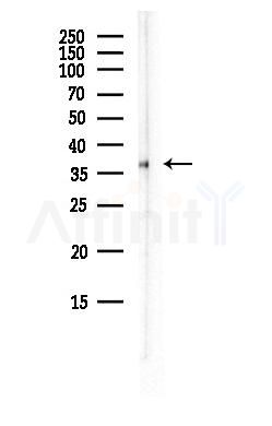 GAPDH Antibody - Western blot analysis of lysates from HepG2 cells(LPS, 4h treatment), using GAPDH Antibody at 1/1000 dilution.