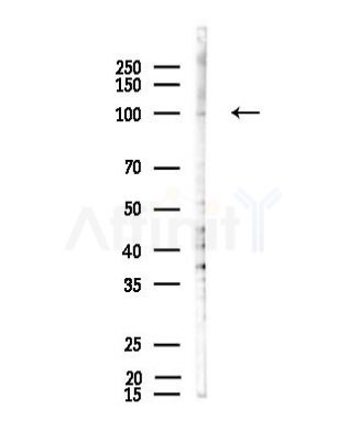 ROR1 Antibody - Western blot analysis of lysates from COLO205 cells(LPS, 4h treatment), using ROR1 Antibody at 1/1000 dilution.