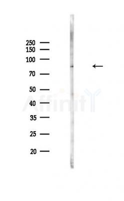 Phospho-SKI (Ser383) Antibody - Western blot analysis of lysates from Mouse lung, using Phospho-SKI (Ser383) Antibody at 1/1000 dilution.