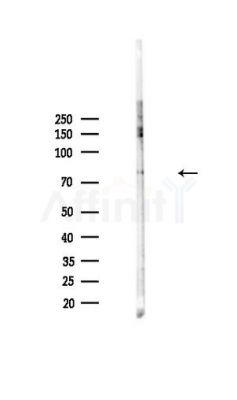 Phospho-SKI (Ser383) Antibody - Western blot analysis of lysates from HepG2 cells(heat-shock,45min treatment), using Phospho-SKI (Ser383) Antibody at 1/1000 dilution.