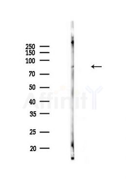 Phospho-SKI (Ser383) Antibody - Western blot analysis of lysates from HUVEC cells, using Phospho-SKI (Ser383) Antibody at 1/1000 dilution.