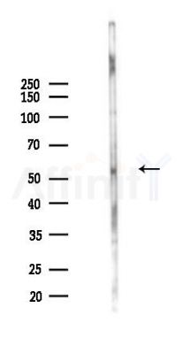 Phospho-KCNA1 (Ser446) Antibody - Western blot analysis of lysates from HUVEC cells(UV,30min treatment), using Phospho-KCNA1 (Ser446) Antibody at 1/1000 dilution.
