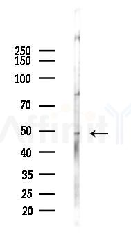 Phospho-TFAP2C (Ser434) Antibody - Western blot analysis of lysates from K562 cells(UV, 30min treatment), using Phospho-TFAP2C (Ser434) Antibody at 1/1000 dilution.