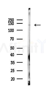 Phospho-LPIN1 (Thr14) Antibody - Western blot analysis of lysates from HUVEC cells(UV, 30min treatment), using Phospho-LPIN1 (Thr14) Antibody at 1/1000 dilution.
