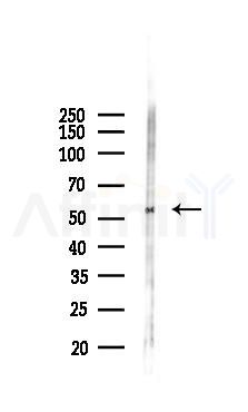 Phospho-RIPK2 (Ser531) Antibody - Western blot analysis of lysates from RAW264.