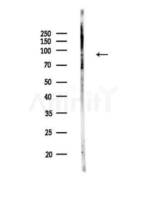 Phospho-FOXO3A (Ser555) Antibody - Western blot analysis of lysates from EC304 cells(LPS,4h treatment), using Phospho-FOXO3A (Ser555) Antibody at 1/1000 dilution.