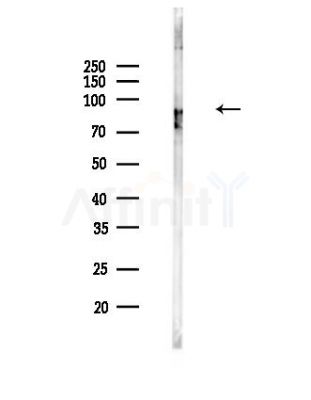 Phospho-FOXO3A (Ser555) Antibody - Western blot analysis of lysates from PC12 cells, using Phospho-FOXO3A (Ser555) Antibody at 1/1000 dilution.
