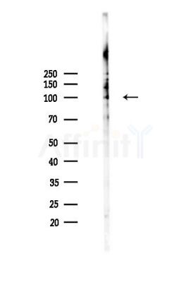 Phospho-FOXO3A (Ser555) Antibody - Western blot analysis of lysates from MDA-MB-231 cells(heat-shock,45min treatment), using Phospho-FOXO3A (Ser555) Antibody at 1/1000 dilution.