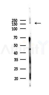 Phospho-AS160 (Ser570) Antibody - Western blot analysis of lysates from PC12 cells(starvation, 24h treatment), using Phospho-AS160 (Ser570) Antibody at 1/1000 dilution.