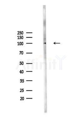 Phospho-CTNND1 (Tyr280) Antibody - Western blot analysis of lysates from MDA-MB-231 cells(heat-shock,45min treatment), using Phospho-CTNND1 (Tyr280) Antibody at 1/1000 dilution.