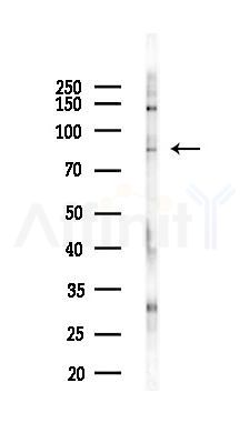 Phospho-p95/NBS1 (Ser432) Antibody - Western blot analysis of lysates from PC12 cells(UV,30min treatment), using Phospho-p95/NBS1 (Ser432) Antibody at 1/1000 dilution.