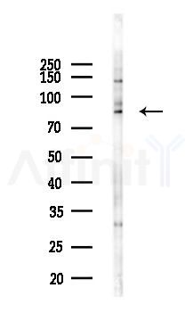 Phospho-p95/NBS1 (Ser432) Antibody - Western blot analysis of lysates from HUVEC cells(UV,30min treatment), using Phospho-p95/NBS1 (Ser432) Antibody at 1/1000 dilution.
