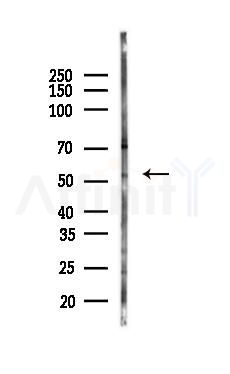 Phospho-MITF (Ser516) Antibody - Western blot analysis of lysates from COLO205 cells(LPS,4h treatment), using Phospho-MITF (Ser516) Antibody at 1/1000 dilution.