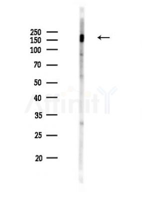 Phospho-ROCK2 (Ser1379) Antibody - Western blot analysis of lysates from EC304 cells(LPS,4h treatment), using Phospho-ROCK2 (Ser1379) Antibody at 1/1000 dilution.
