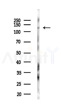 Phospho-IRE1 (Tyr628) Antibody - Western blot analysis of lysates from PC12 cells(UV,30min treatment), using Phospho-IRE1 (Tyr628) Antibody at 1/1000 dilution.