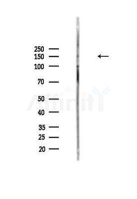 Phospho-NFAT5 (Ser145) Antibody - Western blot analysis of lysates from MDA-MB-231 cells(heat-shock,45min treatment), using Phospho-NFAT5 (Ser145) Antibody at 1/1000 dilution.