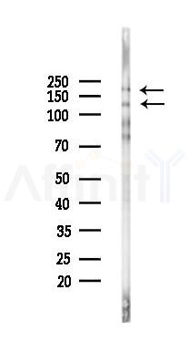 Phospho-LATS1 (Tyr283) Antibody - Western blot analysis of lysates from K562 cells(UV,30min treatment), using Phospho-LATS1 (Tyr283) Antibody at 1/1000 dilution.