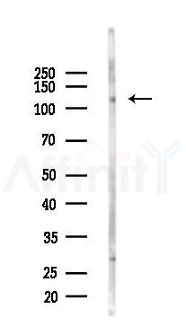Phospho-TrkA (Tyr791) Antibody - Western blot analysis of lysates from PC12 cells(UV,30min treatment), using Phospho-TrkA (Tyr791) Antibody at 1/1000 dilution.