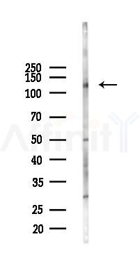 Phospho-TrkA (Tyr791) Antibody - Western blot analysis of lysates from HUVEC cells(UV,30min treatment), using Phospho-TrkA (Tyr791) Antibody at 1/1000 dilution.