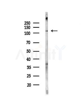 Phospho-Integrin beta 1 (Tyr795) Antibody - Western blot analysis of lysates from PC12 cells(UV,30min treatment), using Phospho-Integrin beta 1 (Tyr795) Antibody at 1/1000 dilution.