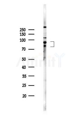 Phospho-PKC beta 1 (Ser661) Antibody - Western blot analysis of lysates from MDA-MB-231 cells(heat-shock,45min treatment), using Phospho-PKC beta 1 (Ser661) Antibody at 1/1000 dilution.