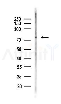 Phospho-PKC beta 1 (Thr642+Thr644) Antibody  - Western blot analysis of lysates from COLO205 cells(LPS,4h treatment), using Phospho-PKC beta 1 (Thr642+Thr644) Antibody  at 1/1000 dilution.