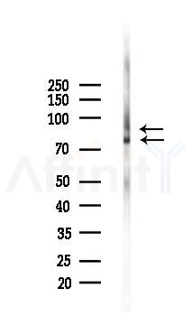 Phospho-PKC beta 1 (Thr642+Thr644) Antibody  - Western blot analysis of lysates from K562 cells(UV,30min treatment), using Phospho-PKC beta 1 (Thr642+Thr644) Antibody  at 1/1000 dilution.