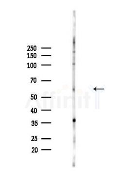 Phospho-Fyn (Tyr213+Tyr214) Antibody - Western blot analysis of lysates from MDA-MB-231 cells(heat-shock,45min treatment), using Phospho-Fyn (Tyr213+Tyr214) Antibody at 1/1000 dilution.