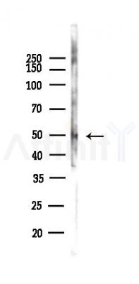 Phospho-Vimentin (Tyr117) Antibody - Western blot analysis of lysates from Hela cells(heat-shock,45min treatment), using Phospho-Vimentin (Tyr117) Antibody at 1/1000 dilution.
