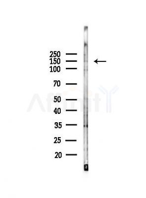 Phospho-Bcr (Ser301) Antibody - Western blot analysis of lysates from COLO205 cells(heat-shock, 45min treatment), using Phospho-Bcr (Ser301) Antibody at 1/1000 dilution.