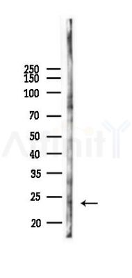 Phospho-TCTP (Ser53) Antibody - Western blot analysis of lysates from B16F10-LUC cells(starvation,24h treatment), using Phospho-TCTP (Ser53) Antibody at 1/1000 dilution.