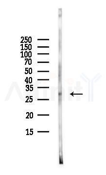 Phospho-Coagulation Factor III (Ser290) Antibody - Western blot analysis of lysates from HUVEC cells(starvation,24h treatment), using Phospho-Coagulation Factor III (Ser290) Antibody at 1/1000 dilution.