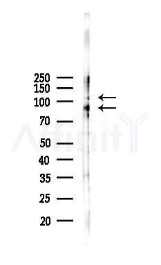 Phospho-WEE1 (Ser139) Antibody - Western blot analysis of lysates from COLO205 cells(heat-shock,45min treatment), using Phospho-WEE1 (Ser139) Antibody at 1/1000 dilution.