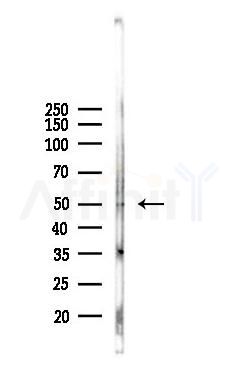 Phospho-CDC25C (Thr48) Antibody - Western blot analysis of lysates from COLO205 cells(heat-shock,45min treatment), using Phospho-CDC25C (Thr48) Antibody at 1/1000 dilution.