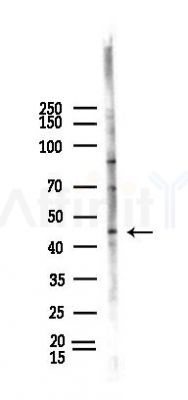 Phospho-C/EBP alpha (Thr226) Antibody - Western blot analysis of lysates from HUVEC cells(heat-shock,45min treatment), using Phospho-C/EBP alpha (Thr226) Antibody at 1/1000 dilution.