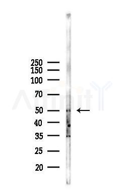 Phospho-YB1 (Tyr162) Antibody - Western blot analysis of lysates from COLO205 cells(heat-shock,45min treatment), using Phospho-YB1 (Tyr162) Antibody at 1/1000 dilution.