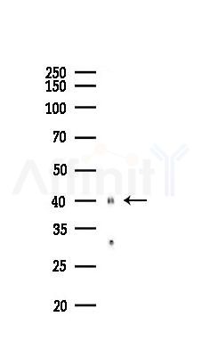 Phospho-CKII alpha (Thr360) Antibody - Western blot analysis of lysates from EC304 cells(UV,30min treatment), using Phospho-CKII alpha (Thr360) Antibody at 1/1000 dilution.