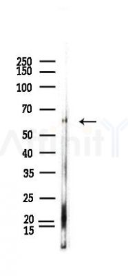 Phospho-MEF2C (Ser396) Antibody - Western blot analysis of lysates from Hela cells(LPS,4h treatment), using Phospho-MEF2C (Ser396) Antibody at 1/1000 dilution.