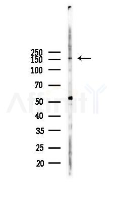 Phospho-NMDAR2A (Tyr943) Antibody - Western blot analysis of lysates from COLO205 cells(heat-shock,45min treatment), using Phospho-NMDAR2A (Tyr943) Antibody at 1/1000 dilution.