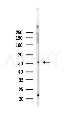 Phospho-TRAF2 (Thr22) Antibody - Western blot analysis of lysates from K562 cells(heat-shock,45min treatment), using Phospho-TRAF2 (Thr22) Antibody at 1/1000 dilution.