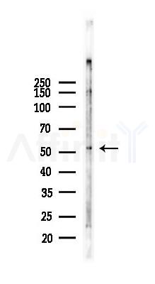 Phospho-TRAF2 (Thr22) Antibody - Western blot analysis of lysates from COLO205 cells(heat-shock,45min treatment), using Phospho-TRAF2 (Thr22) Antibody at 1/1000 dilution.