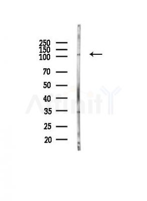Phospho-PLD1 (Ser561) Antibody - Western blot analysis of lysates from PC12 cells(heat-shock, 45min treatment), using Phospho-PLD1 (Ser561) Antibody at 1/1000 dilution.