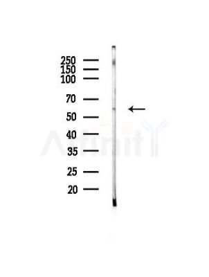 Phospho-IRF3 (Ser14) Antibody - Western blot analysis of lysates from PC12 cells(heat-shock, 45min treatment), using Phospho-IRF3 (Ser14) Antibody at 1/1000 dilution.