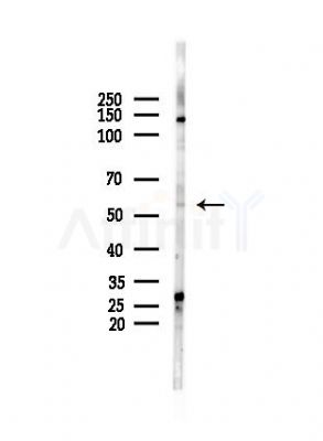 Phospho-MEF2D (Ser180) Antibody - Western blot analysis of lysates from PC12 cells, using Phospho-MEF2D (Ser180) Antibody at 1/1000 dilution.