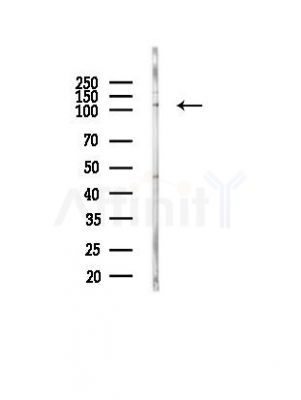 Phospho-NFAT3 (Ser289) Antibody - Western blot analysis of lysates from PC12 cells(heat-shock, 45min treatment), using Phospho-NFAT3 (Ser289) Antibody at 1/1000 dilution.