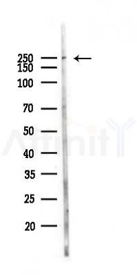 Phospho-NuMA (Ser1225) Antibody - Western blot analysis of lysates from 293 cells(UV,30min treatment), using Phospho-NuMA (Ser1225) Antibody at 1/1000 dilution.