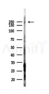Phospho-NuMA (Ser1225) Antibody - Western blot analysis of lysates from HUVEC cells(starvation,24h treatment), using Phospho-NuMA (Ser1225) Antibody at 1/1000 dilution.